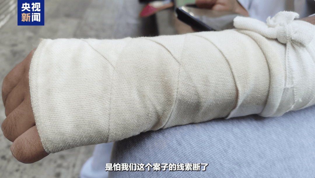 被游客掰断手臂的NPC系一级运动员